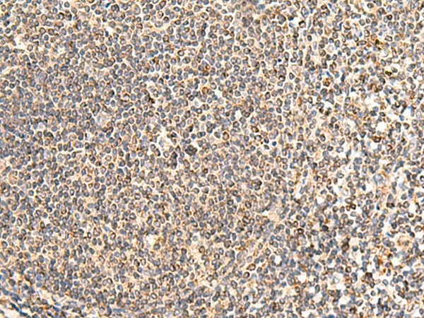NEGR1 Polyclonal Antibody (E-AB-52861)