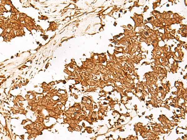HUS1 Polyclonal Antibody (E-AB-18816)
