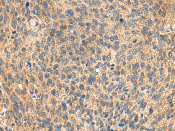 MIA Polyclonal Antibody (E-AB-19118)