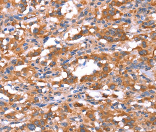 FAM13B Polyclonal Antibody (E-AB-16425)