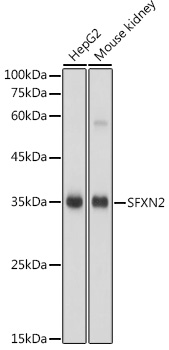SFXN2 Polyclonal Antibody (E-AB-91918)