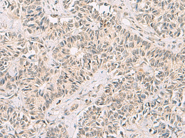 RNF13 Polyclonal Antibody (E-AB-19012)