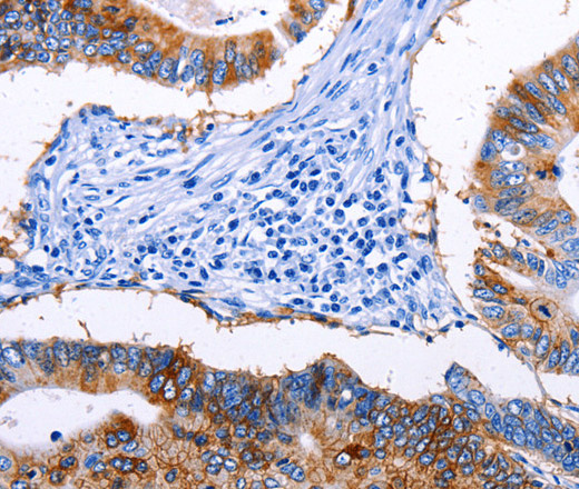 EPCAM Polyclonal Antibody (E-AB-15620)