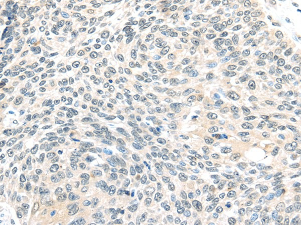 ELOC Polyclonal Antibody (E-AB-17057)