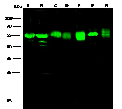 Recombinant ADSL/Adenylosuccinate Lyase Monoclonal Antibody (AN300398P)