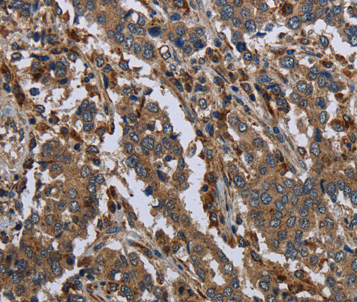 GYS2 Polyclonal Antibody (E-AB-15079)