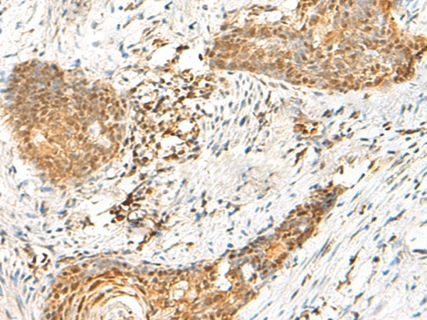 HMBOX1 Polyclonal Antibody (E-AB-19993)