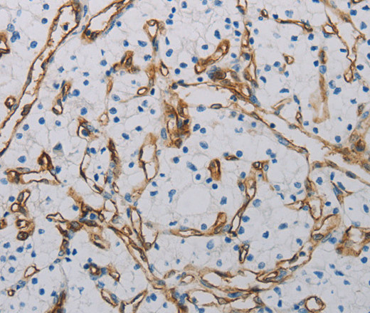 CD31 Polyclonal Antibody (E-AB-12629)