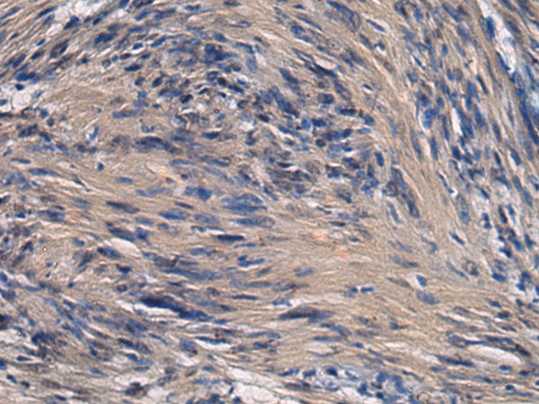 ICA1 Polyclonal Antibody (E-AB-19237)