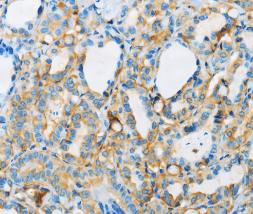 ARSA Polyclonal Antibody (E-AB-14620)