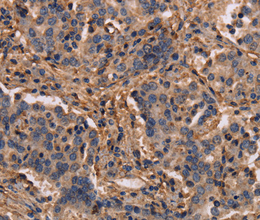 MAP1LC3C Polyclonal Antibody (E-AB-13378)