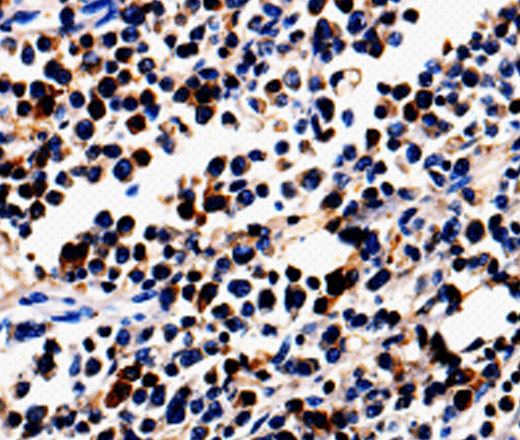 ALOX5 Polyclonal Antibody (E-AB-10040)