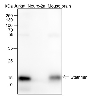 Recombinant Stathmin Monoclonal Antibody (AN301665L)