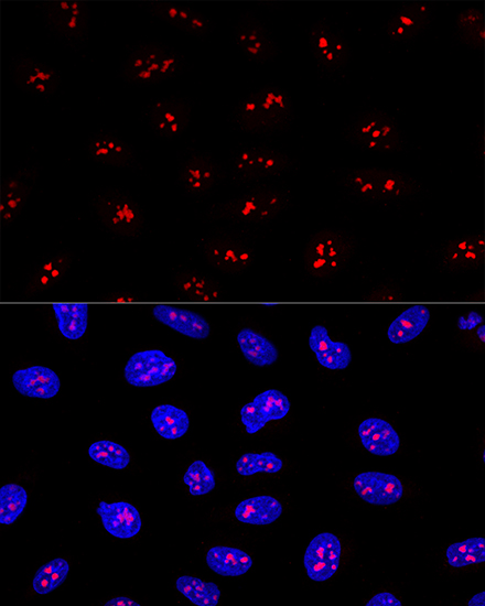 EBNA1BP2 Polyclonal Antibody (E-AB-63939)