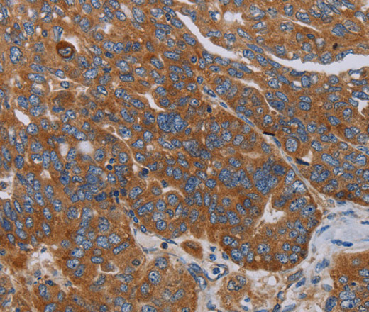 PARP10 Polyclonal Antibody (E-AB-13492)