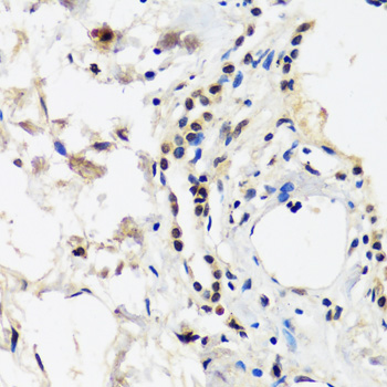 CAND1 Polyclonal Antibody (E-AB-66264)