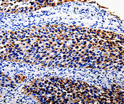 COX10 Polyclonal Antibody (E-AB-13841)