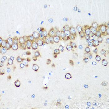 MTDH Polyclonal Antibody (E-AB-62557)