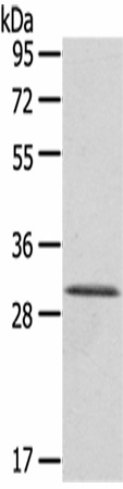 HTATIP2 Polyclonal Antibody (E-AB-17094)