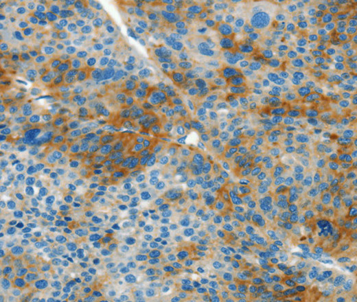 L1CAM Polyclonal Antibody (E-AB-16230)