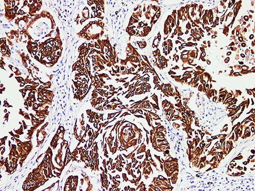 CK-Pan Monoclonal Antibody (ELAB6700-M)