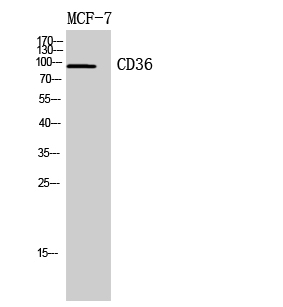 CD36 Polyclonal Antibody (E-AB-33662)