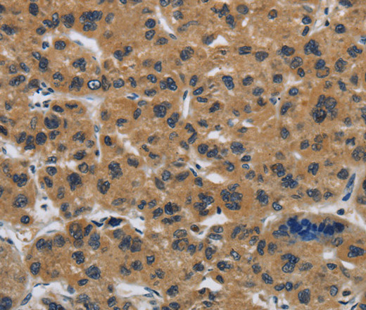 Claudin 2 Polyclonal Antibody (E-AB-12456)