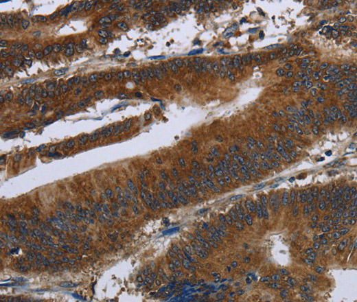 ARHGEF12 Polyclonal Antibody (E-AB-16558)