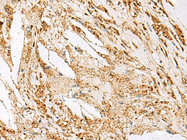 DNPEP Polyclonal Antibody (E-AB-18839)
