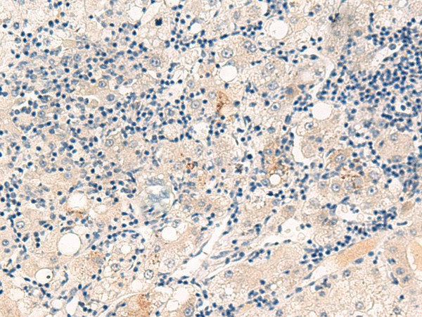 CYYR1 Polyclonal Antibody (E-AB-52891)