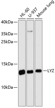 LYZ Polyclonal Antibody (E-AB-64686)