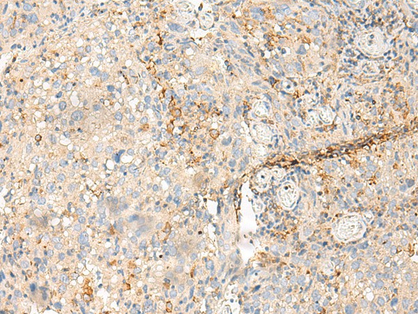 MDFI Polyclonal Antibody (E-AB-52715)
