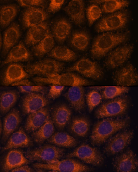 CCT6B Polyclonal Antibody (E-AB-66314)