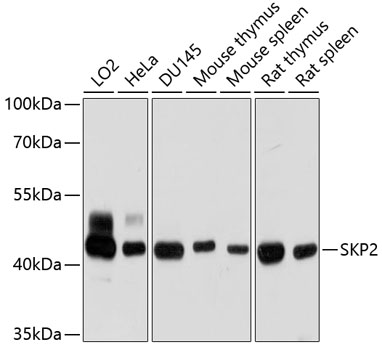 SKP2 Polyclonal Antibody (E-AB-62215)