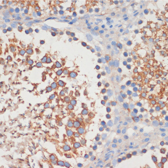 CDC42 Polyclonal Antibody (E-AB-60243)