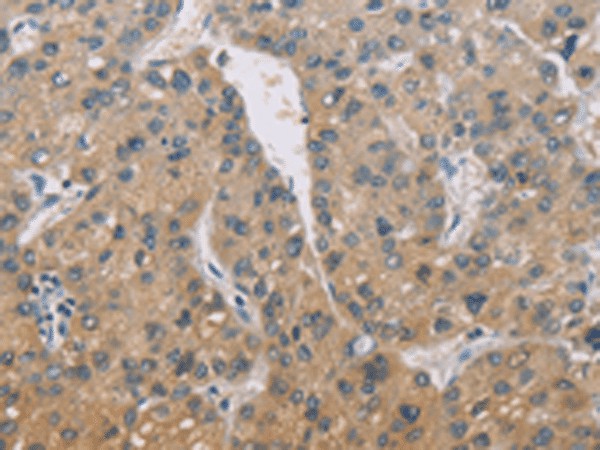 ZBTB6 Polyclonal Antibody (E-AB-53229)
