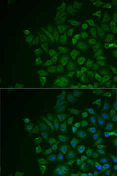 LRAT Polyclonal Antibody (E-AB-64518)