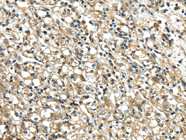NME2 Polyclonal Antibody (E-AB-17455)