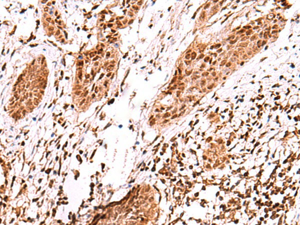 AK9 Polyclonal Antibody (E-AB-19029)