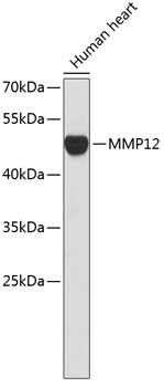 MMP12 Polyclonal Antibody (E-AB-67049)