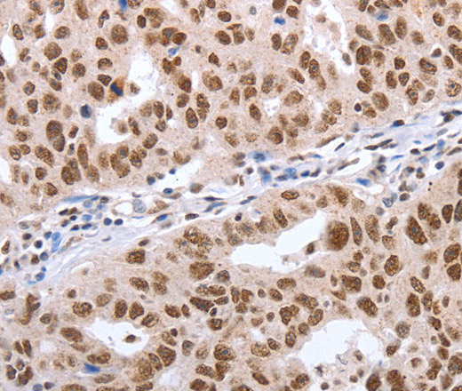 Oct-6 Polyclonal Antibody (E-AB-12827)