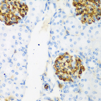 CSRNP1 Polyclonal Antibody (E-AB-61545)