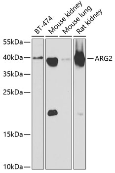 ARG2 Polyclonal Antibody (E-AB-61901)