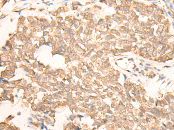 EMSY Polyclonal Antibody (E-AB-17907)