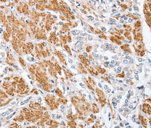 CENPC Polyclonal Antibody (E-AB-14864)