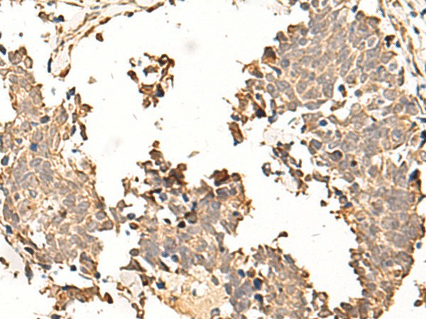 SOX3 Polyclonal Antibody (E-AB-53348)
