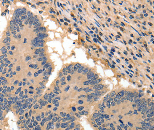 BAIAP2 Polyclonal Antibody (E-AB-10414)