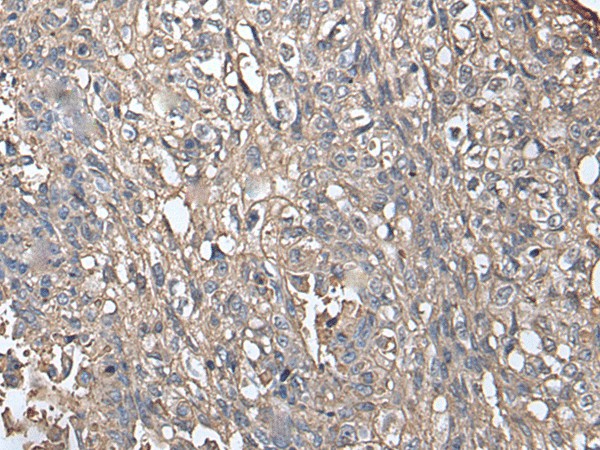 NDUFB5 Polyclonal Antibody (E-AB-52257)