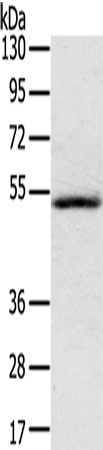 IL17RB Polyclonal Antibody (E-AB-16512)