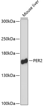 PER2 Polyclonal Antibody (E-AB-66019)